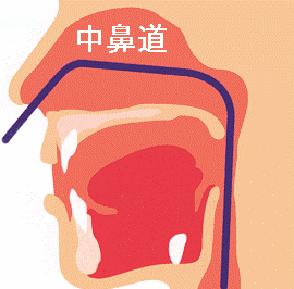 経鼻的胃内視鏡