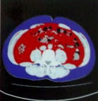 医療法人信和会 和田病院